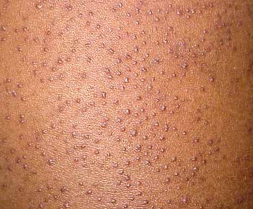 tiny-red-dots-on-skin