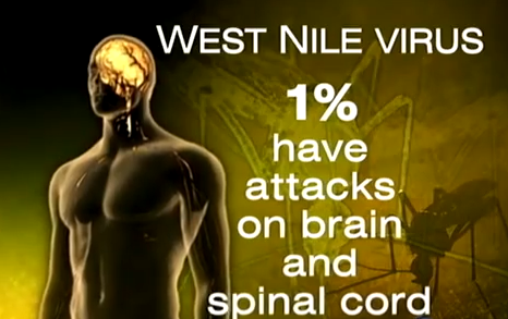 West Nile Virus Symptoms in Adults